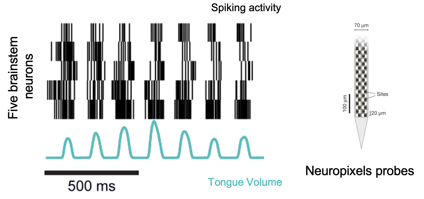 Brainstem spikes